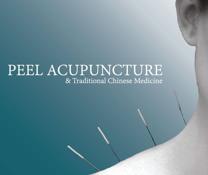 Peel Acupuncture 1